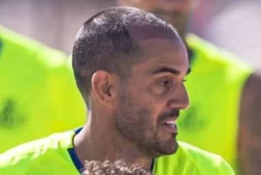 Juanmi Jiménez Getafe CF tratamiento capilar